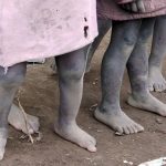 feet of batwa tribe pygmies in Ruhengeri Rwanda